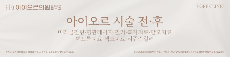 아이오르 시술전후